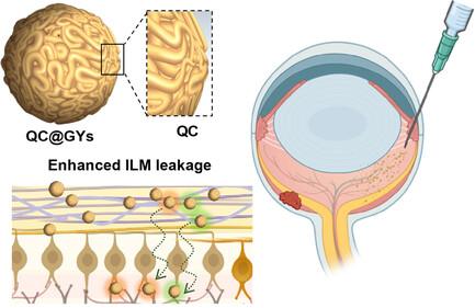 Ophthalmic Tethered Gold Yarnball-Mediated Retained Drug Delivery for Eye Fundus Disease Treatment