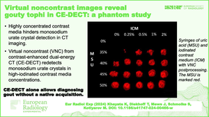 Virtual noncontrast images reveal gouty tophi in contrast-enhanced dual-energy CT: a phantom study.