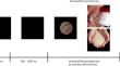 Identification of Methamphetamine Abusers Can Be Supported by EEG-Based Wavelet Transform and BiLSTM Networks.