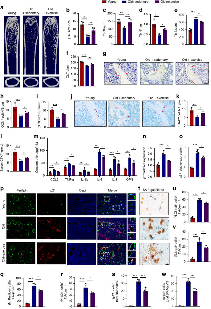 PCLAF induces bone marrow adipocyte senescence and contributes to skeletal aging.