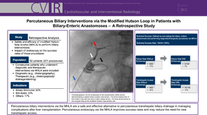 Percutaneous Biliary Interventions via the Modified Hutson Loop in Patients with Biliary-Enteric Anastomoses: A Retrospective Study.