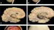 Photogrammetry scans for neuroanatomy education - a new multi-camera system: technical note.