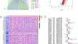 Integrative machine learning and neural networks for identifying PANoptosis-related lncRNA molecular subtypes and constructing a predictive model for head and neck squamous cell carcinoma.