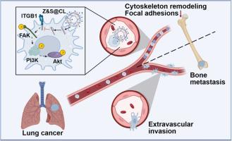 ITGB1 serves as a therapeutic target for reducing lung cancer bone metastasis