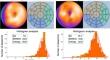 Correction: Novel indices representing heterogeneous distributions of myocardial perfusion imaging