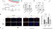 TRIM37 interacts with EZH2 to epigenetically suppress PTCH1 and regulate stemness in glioma stem cells through sonic hedgehog pathway.