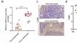 MiR-214 promotes the antitumor effect of NK cells in colorectal cancer liver metastasis through USP27X/Bim