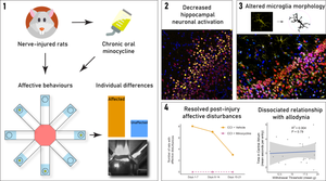 Minocycline Abrogates Individual Differences in Nerve Injury-Evoked Affective Disturbances in Male Rats and Prevents Associated Supraspinal Neuroinflammation.