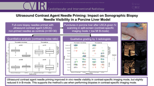 Ultrasound Contrast Agent Needle Priming: Impact on Sonographic Biopsy Needle Visibility in a Porcine Liver Model.