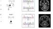 Progressive Ataxia due to de novo Missense Variants in the CACNA1A Gene.