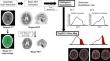 New objective simple evaluation methods of amyloid PET/CT using whole-brain histogram and Top20%-Map.