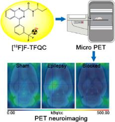 Synthesis and evaluation of TSPO-targeting radioligand [18F]F-TFQC for PET neuroimaging in epileptic rats