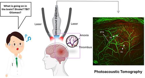 Photoacoustic imaging in brain disorders: Current progress and clinical applications