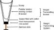 Early Postoperative Prosthesis for Below-Knee Amputee: An Innovative Technique and Design (Siachen Hospital EPOP)