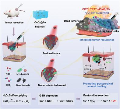 Injectable Therapeutic Hydrogel with H2O2 Self-Supplying and GSH Consumption for Synergistic Chemodynamic/Low-Temperature Photothermal Inhibition of Postoperative Tumor Recurrence and Wound Infection