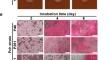 Biofilm formation by the fungus Phaeomoniella chlamydospora: a causal agent of esca disease of grapevine