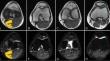 Simultaneous multi-slice technique for reducing acquisition times in diffusion tensor imaging of the knee: a feasibility study.