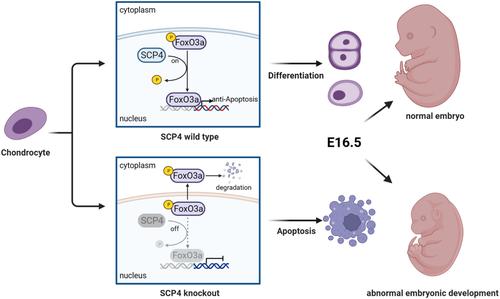 Protein phosphatase SCP4 regulates cartilage development and endochondral osteogenesis via FoxO3a dephosphorylation