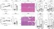 Aging- and alcohol-associated spatial transcriptomic signature in mouse acute pancreatitis reveals heterogeneity of inflammation and potential pathogenic factors.