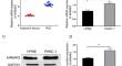 AHNAK2 Regulates NF-κB/MMP-9 Signaling to Promote Pancreatic Cancer Progression.