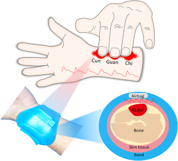 Wearable multichannel-active pressurized pulse sensing platform.