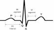 Evaluating FPGA-based denoising techniques for improved signal quality in electrocardiograms