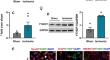 Loss of Epitranscriptomic Modification N<sup>6</sup>-Methyladenosine (m<sup>6</sup>A) Reader YTHDF1 Exacerbates Ischemic Brain Injury in a Sexually Dimorphic Manner.