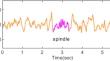 Visual identification of sleep spindles in EEG waveform images using deep learning object detection (YOLOv4 vs YOLOX)