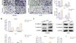 Correction: LncRNA-NNT-AS1 contributes to the progression of glioma by miR-582-5p/EZH2 axis