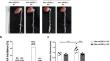 Myeloid Cell mPGES-1 Deletion Attenuates Calcium Phosphate-induced Abdominal Aortic Aneurysm in Male Mice.