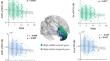 Regional brain structure mediates the association between sleep quality and intellectual abilities: the moderating role of socioeconomic status.