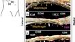 The key to success in blocking lateral cutaneous branches with re-modified thoracoabdominal nerves block through perichondrial approach: a newly discovered space between the endothoracic fascia, diaphragm, and costodiaphragmatic recess.