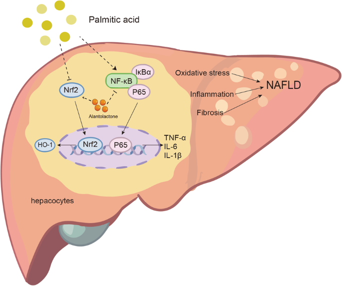 Alantolactone attenuates high-fat diet-induced inflammation and oxidative stress in non-alcoholic fatty liver disease.