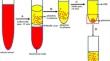 Exploring the Efficacy of Biologics in Knee Osteoarthritis: Ultrasound Evaluation of Cartilage Regeneration Effects