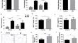 Sleep deprivation induced fat accumulation in the visceral white adipose tissue by suppressing SIRT1/FOXO1/ATGL pathway activation.