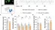 Microglial EPOR Contribute to Sevoflurane-induced Developmental Fine Motor Deficits Through Synaptic Pruning in Mice.