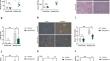 Ginkgolide C attenuated Western diet-induced non-alcoholic fatty liver disease via increasing AMPK activation.