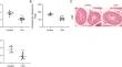 MicroRNA-361-5p Alleviates Leydig Cell Apoptosis and Promotes Cell Growth by Targeting PIAS1 in Late-Onset Hypogonadism.