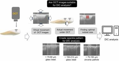 Assessments of polymerization shrinkage by optical coherence tomography-based digital image correlation analysis—Part I: Parameter identification