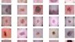 An effective multiclass skin cancer classification approach based on deep convolutional neural network