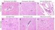 Limited HIV-associated neuropathologies and lack of immune activation in sub-saharan African individuals with late-stage subtype C HIV-1 infection.