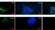 The effect of epididymosomes on the development of frozen-thawed mouse spermatogonial stem cells after culture in a decellularized testicular scaffold and transplantation into azoospermic mice.