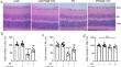 Ucf-101 alleviates Ischaemia/Reperfusion induced retinal inflammation and injury via suppressing oxidative damage.