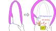 Updated pathophysiological overview of functional MR (ventricular and atrial).