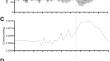 Rapid changes in cerebrovascular compliance during vasovagal syncope.