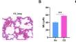 Deficiency of Secreted Phosphoprotein 1 Alleviates Hyperoxia-induced Bronchopulmonary Dysplasia in Neonatal Mice.