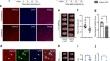 HDAC9 Deficiency Upregulates cGMP-dependent Kinase II to Mitigate Neuronal Apoptosis in Ischemic Stroke.