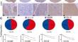 Enhancing hepatocellular carcinoma management: prognostic value of integrated CCL17, CCR4, CD73, and HHLA2 expression analysis.