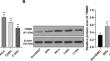 TRIM8 Promotes Proliferation, Invasion, and Migration of Cervical Cancer Cells by Ubiquitinating and Degrading SOCS1.