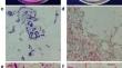 Control of coptis root rot by combination of Bacillus cereus isolate Y9 and other antagonistic microorganisms